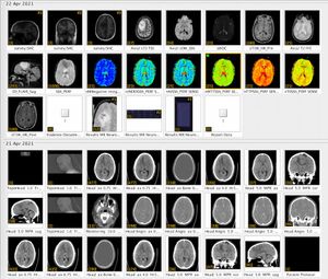 Image of lots of thumbnails of my head. All the images captured in the scans!